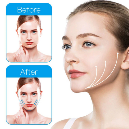 Apex Jawline Trainer — Bite Resistance Jaw Exerciser
